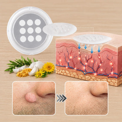 PURESHADE® 2v1 mikrojehličková + hydrokoloidní náplast🍀 | Pomáhá odstraňovat vystouplá znaménka, akné, ploché bradavice a kožní výrůstky | Pomáhá zjemnit vrásky, jizvy a nedokonalosti pleti | Diskrétní neviditelná náplast pro obličej i tělo