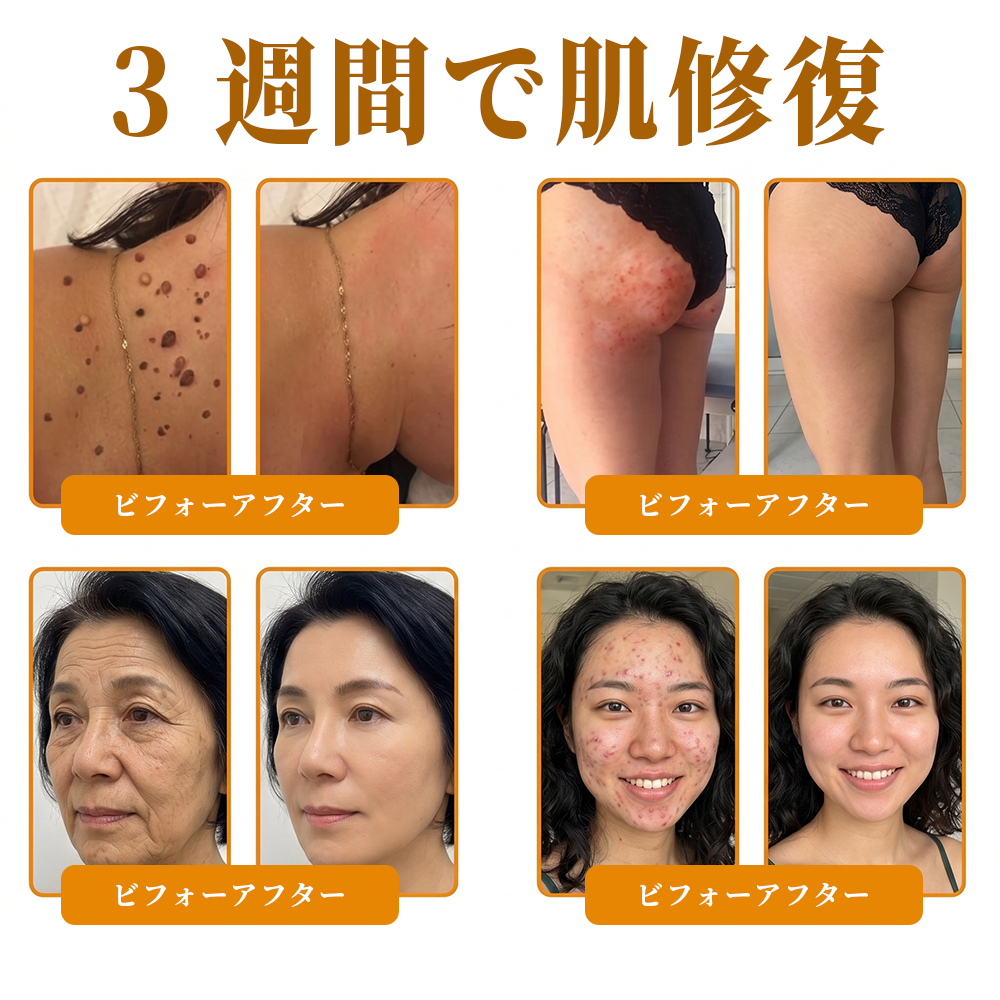 エイジング悩み対策サポート🐝🥇 𝖠𝖯𝖪𝖠𝖯𝖪® ハチ毒トータルスキンケアクリーム🔥