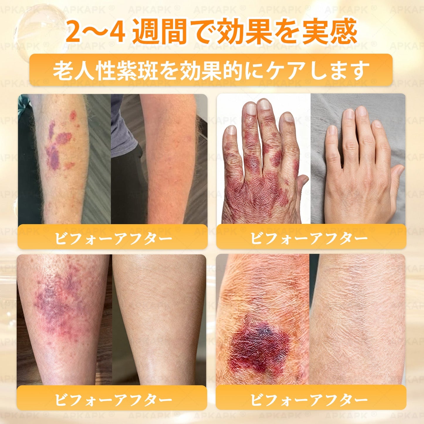 エイジング悩み対策サポート🐝🥇 𝖠𝖯𝖪𝖠𝖯𝖪® ハチ毒トータルスキンケアクリーム🔥