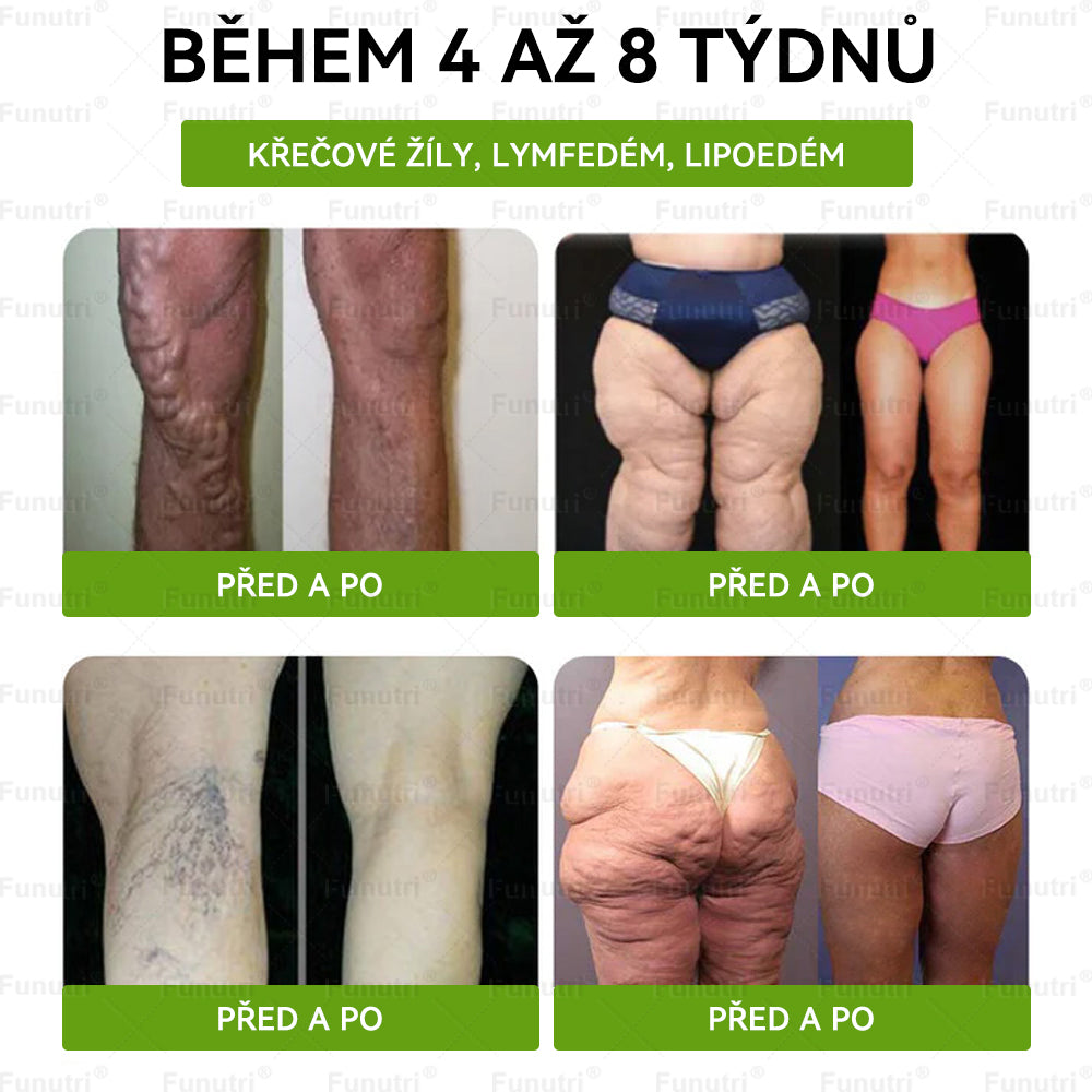Oficiální obchod 🍀 Funutri® 10 v 1 metabolická tvarující náplast s nano mikrojehličkami (Pouze jednou denně, viditelné změny již za 7 dní)  Určeno pro osoby s obezitou, diabetem, spánkovou apnoe