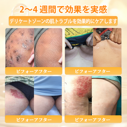 エイジング悩み対策サポート🐝🥇 𝖠𝖯𝖪𝖠𝖯𝖪® ハチ毒トータルスキンケアクリーム🔥