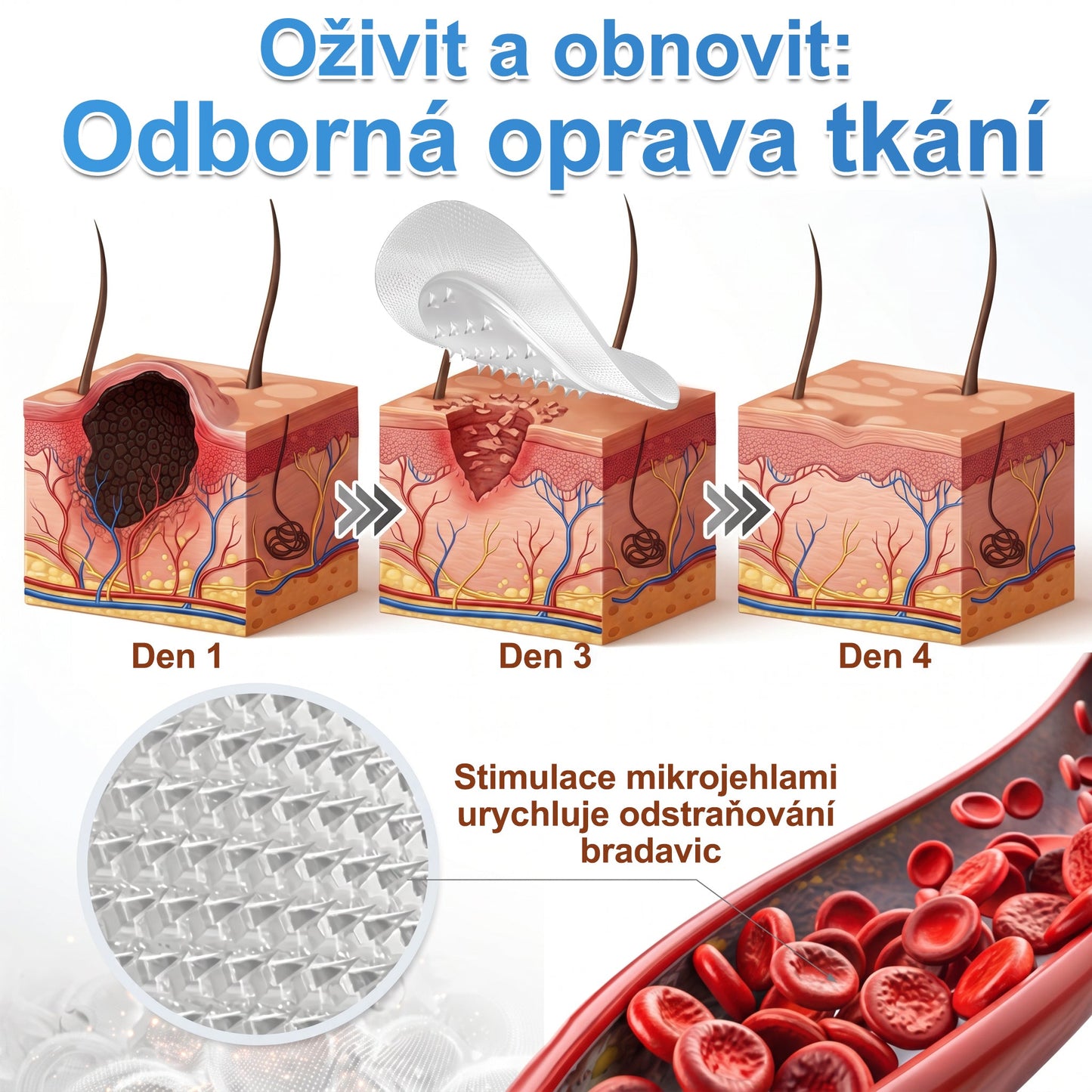 PURESHADE® 2v1 mikrojehličková + hydrokoloidní náplast🍀 | Pomáhá odstraňovat vystouplá znaménka, akné, ploché bradavice a kožní výrůstky | Pomáhá zjemnit vrásky, jizvy a nedokonalosti pleti | Diskrétní neviditelná náplast pro obličej i tělo