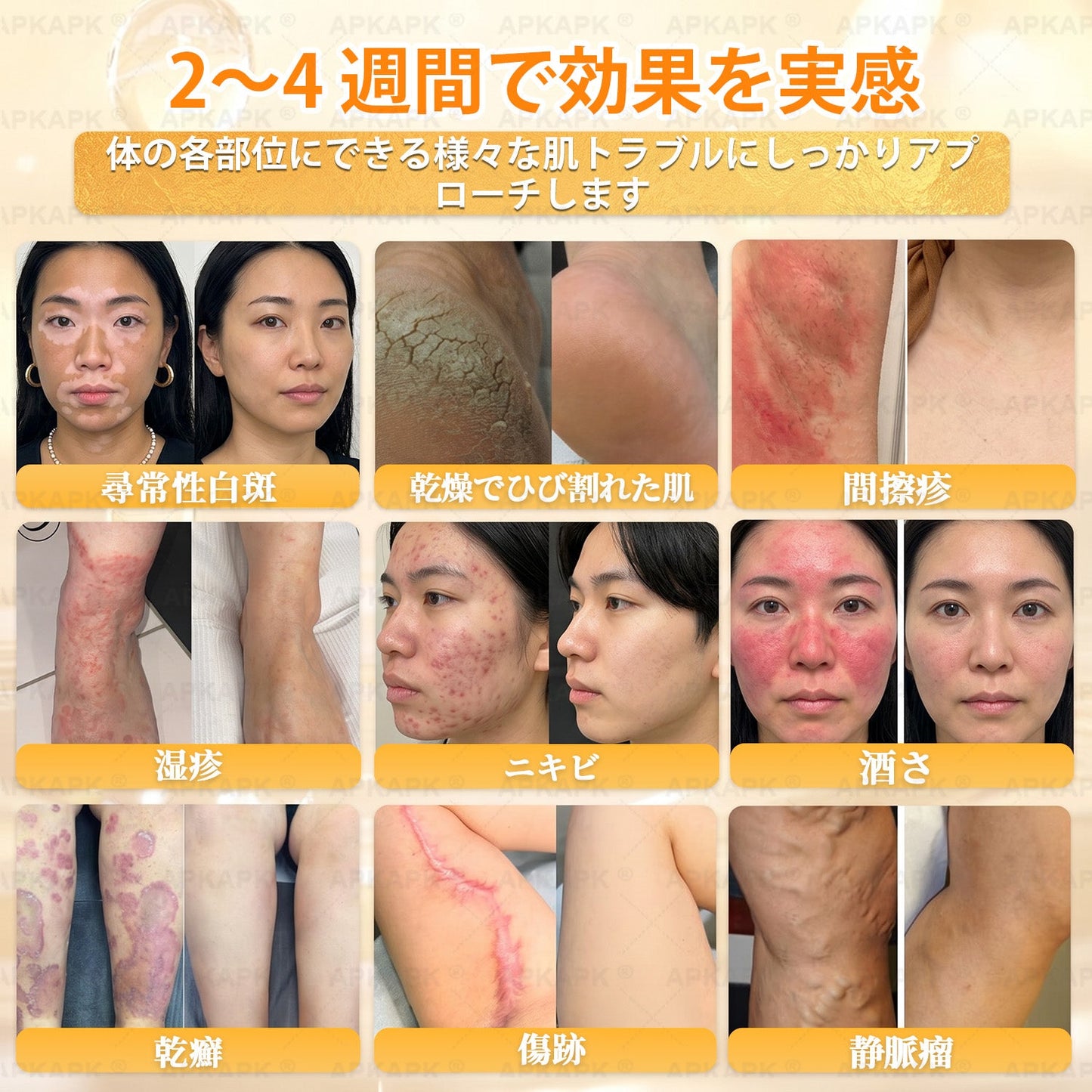 エイジング悩み対策サポート🐝🥇 𝖠𝖯𝖪𝖠𝖯𝖪® ハチ毒トータルスキンケアクリーム🔥