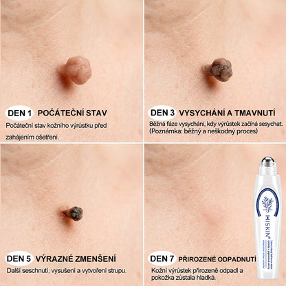 Oficiální značkový obchod | 🐬🐬🐬Hiskin® 7denní odstraňovač skvrn a pigmentových skvrn (Bezbolestný rollerball bez jizev)