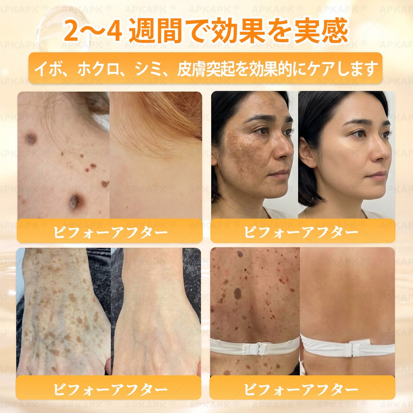 エイジング悩み対策サポート🐝🥇 𝖠𝖯𝖪𝖠𝖯𝖪® ハチ毒トータルスキンケアクリーム🔥