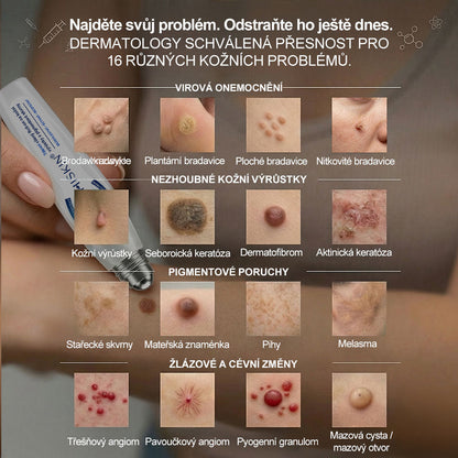 Oficiální značkový obchod | 🐬🐬🐬Hiskin® 7denní odstraňovač skvrn a pigmentových skvrn (Bezbolestný rollerball bez jizev)