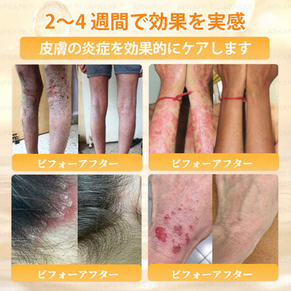 エイジング悩み対策サポート🐝🥇 𝖠𝖯𝖪𝖠𝖯𝖪® ハチ毒トータルスキンケアクリーム🔥