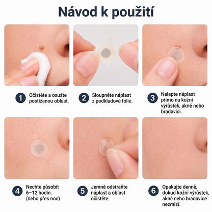 PURESHADE® 2v1 mikrojehličková + hydrokoloidní náplast🍀 | Pomáhá odstraňovat vystouplá znaménka, akné, ploché bradavice a kožní výrůstky | Pomáhá zjemnit vrásky, jizvy a nedokonalosti pleti | Diskrétní neviditelná náplast pro obličej i tělo