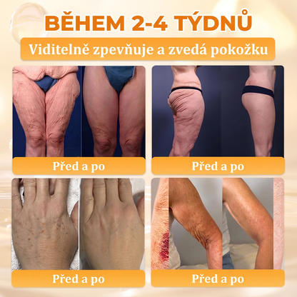 𝖠𝖯𝖪𝖠𝖯𝖪® Krém s včelím jedem na obnovu pokožky 🍯🍯🍯 pomáhá při řešení kožních problémů, jako jsou: vrásky, jizvy, pigmentové skvrny, strie, akné, lupénka, ekzém, kožní léze, podráždění, záněty a další kožní potíže.