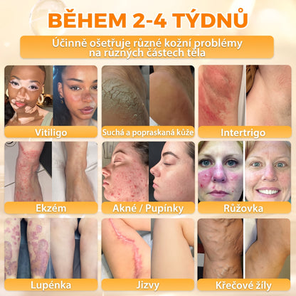 Dermatologicky a klinicky testováno👩‍⚕️APKAPK®Bee Venom Krém na obnovení pleti🐝 pomáhá při léčbě kožních problémů, jako jsou: vrásky, jizvy, pigmentové skvrny, strie, akné, psoriáza, ekzém, kožní změny, podráždění, záněty a další kožní problémy.