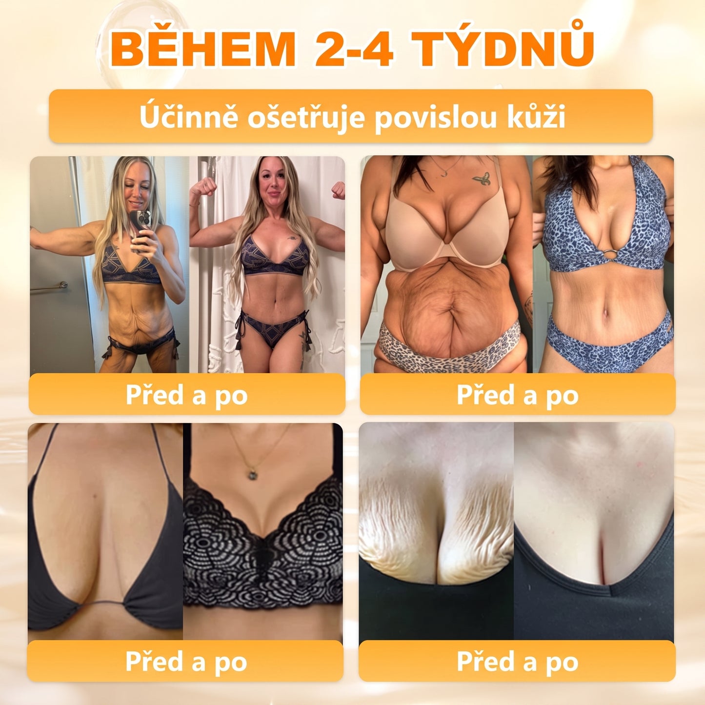 Dermatologicky a klinicky testováno👩‍⚕️APKAPK®Bee Venom Krém na obnovení pleti🐝 pomáhá při léčbě kožních problémů, jako jsou: vrásky, jizvy, pigmentové skvrny, strie, akné, psoriáza, ekzém, kožní změny, podráždění, záněty a další kožní problémy.