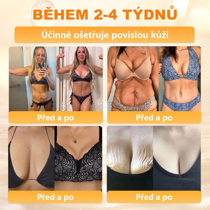 Dermatologicky a klinicky testováno👩‍⚕️APKAPK®Bee Venom Krém na obnovení pleti🐝 pomáhá při léčbě kožních problémů, jako jsou: vrásky, jizvy, pigmentové skvrny, strie, akné, psoriáza, ekzém, kožní změny, podráždění, záněty a další kožní problémy.