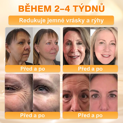 𝖠𝖯𝖪𝖠𝖯𝖪® Krém s včelím jedem na obnovu pokožky 🍯🍯🍯 pomáhá při řešení kožních problémů, jako jsou: vrásky, jizvy, pigmentové skvrny, strie, akné, lupénka, ekzém, kožní léze, podráždění, záněty a další kožní potíže.