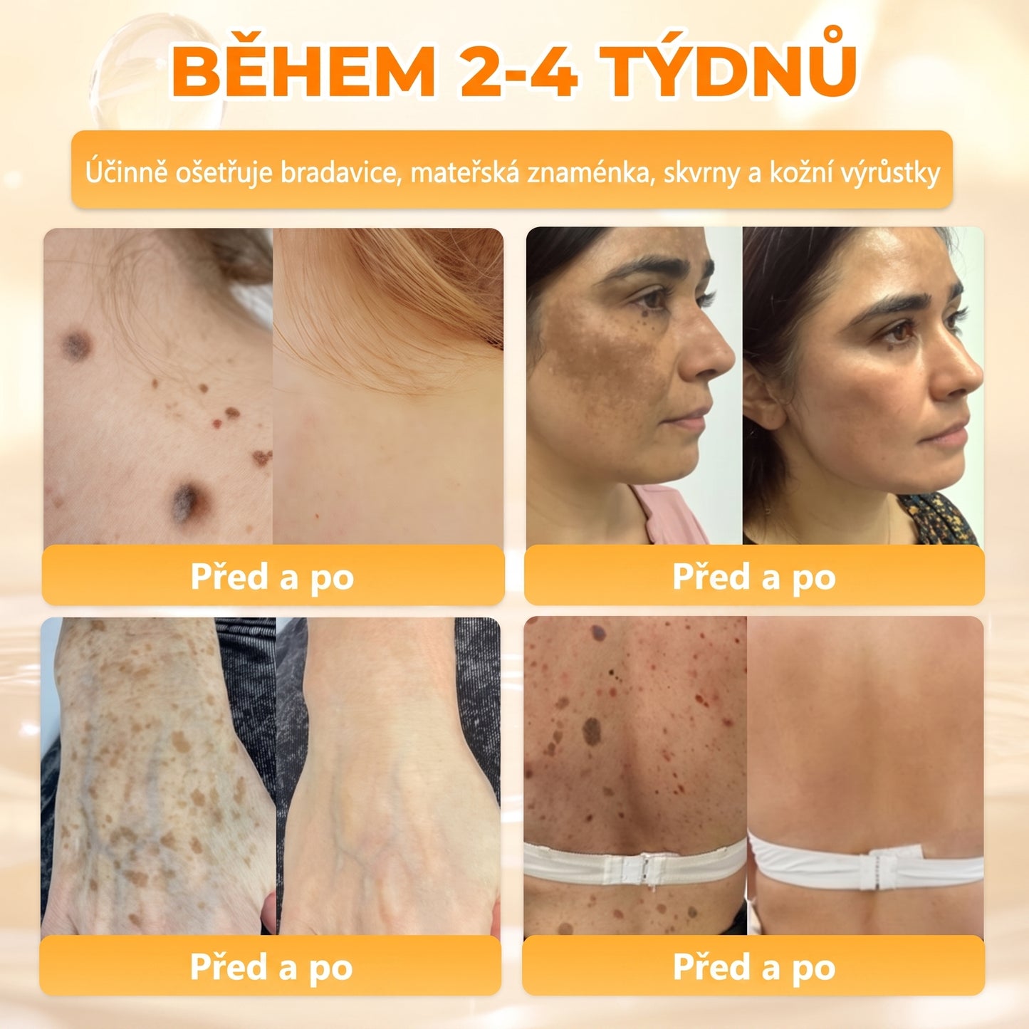 𝖠𝖯𝖪𝖠𝖯𝖪® Krém s včelím jedem na obnovu pokožky 🐝🐝 pomáhá při řešení kožních problémů, jako jsou: vrásky, jizvy, pigmentové skvrny, strie, akné, lupénka, ekzém, kožní léze, podráždění, záněty a další kožní potíže.