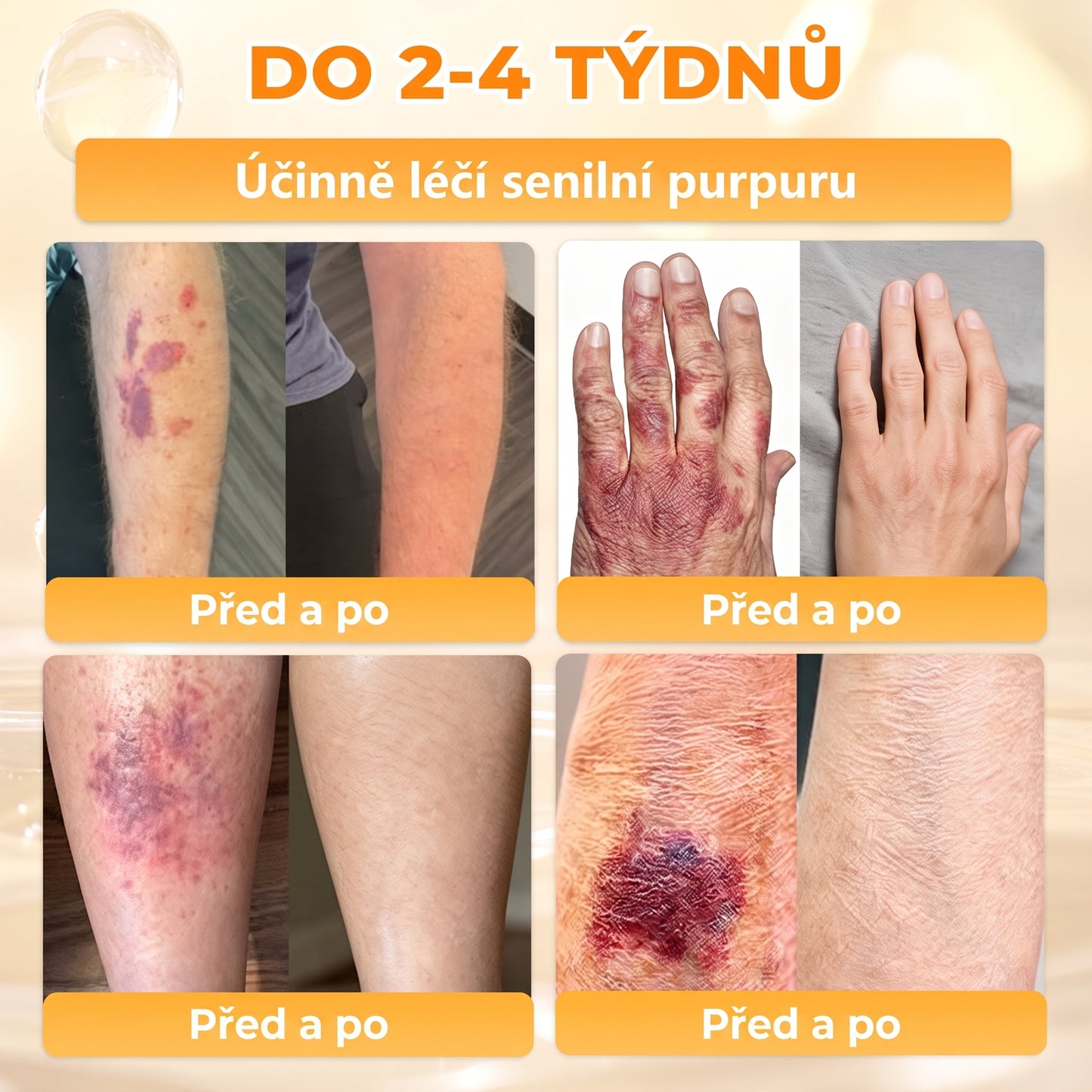𝖠𝖯𝖪𝖠𝖯𝖪® Krém s včelím jedem na obnovu pokožky 🐝🐝 pomáhá při řešení kožních problémů, jako jsou: vrásky, jizvy, pigmentové skvrny, strie, akné, lupénka, ekzém, kožní léze, podráždění, záněty a další kožní potíže.