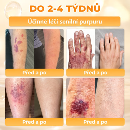 𝖠𝖯𝖪𝖠𝖯𝖪® Krém s včelím jedem na obnovu pokožky 🐝🐝 pomáhá při řešení kožních problémů, jako jsou: vrásky, jizvy, pigmentové skvrny, strie, akné, lupénka, ekzém, kožní léze, podráždění, záněty a další kožní potíže.