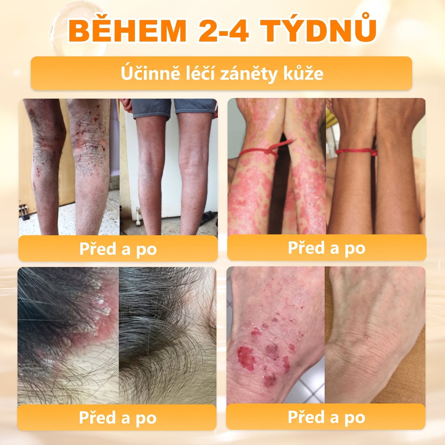 Dermatologicky a klinicky testováno👩‍⚕️APKAPK®Bee Venom Krém na obnovení pleti🐝 pomáhá při léčbě kožních problémů, jako jsou: vrásky, jizvy, pigmentové skvrny, strie, akné, psoriáza, ekzém, kožní změny, podráždění, záněty a další kožní problémy.