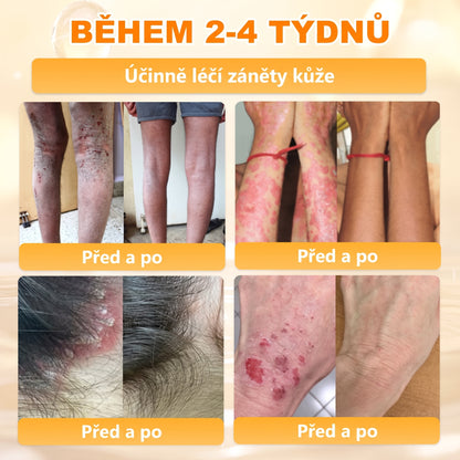 Dermatologicky a klinicky testováno👩‍⚕️APKAPK®Bee Venom Krém na obnovení pleti🐝 pomáhá při léčbě kožních problémů, jako jsou: vrásky, jizvy, pigmentové skvrny, strie, akné, psoriáza, ekzém, kožní změny, podráždění, záněty a další kožní problémy.