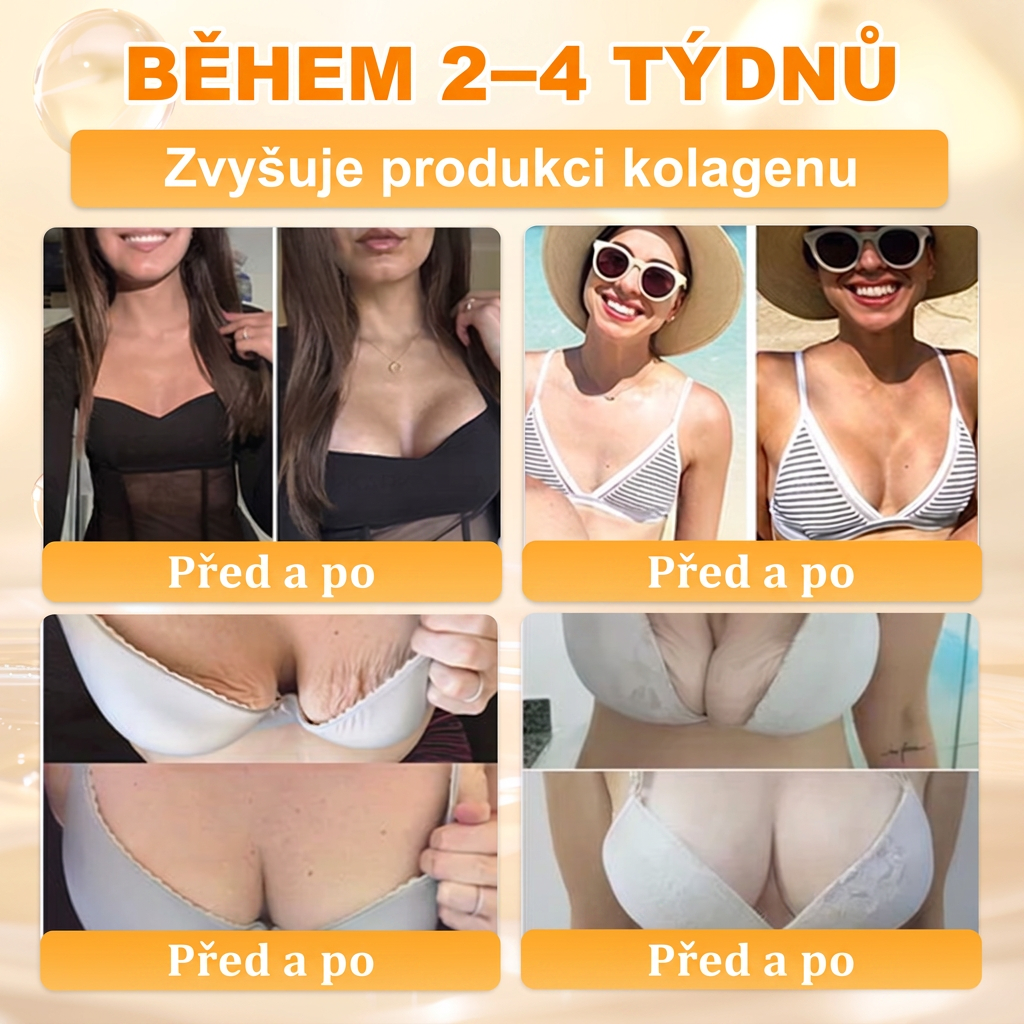 𝖠𝖯𝖪𝖠𝖯𝖪® Krém s včelím jedem na obnovu pokožky 🍯🍯🍯 pomáhá při řešení kožních problémů, jako jsou: vrásky, jizvy, pigmentové skvrny, strie, akné, lupénka, ekzém, kožní léze, podráždění, záněty a další kožní potíže.
